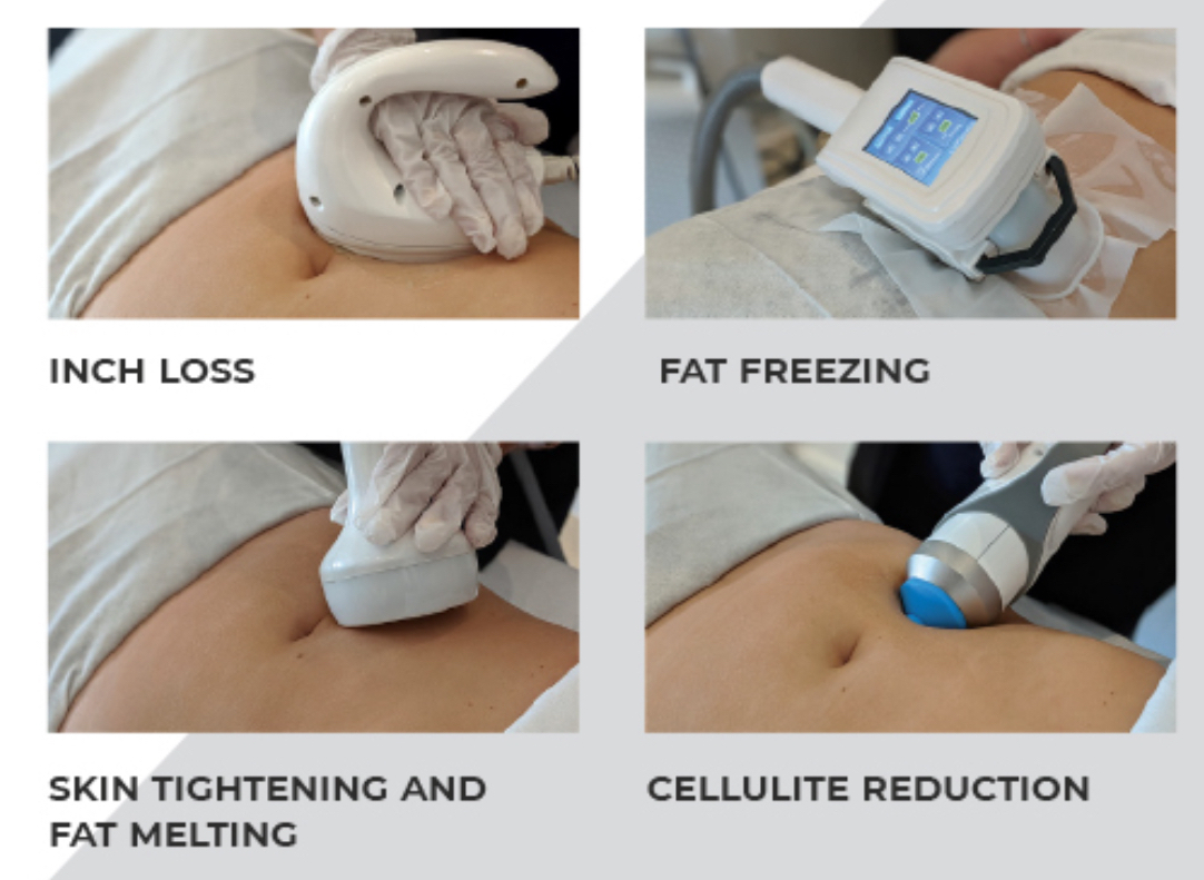 3D Lipo Image
